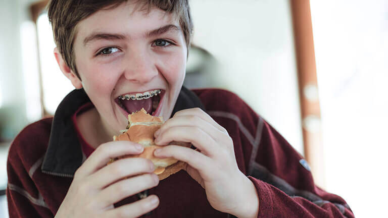 boy with braces eating a burger