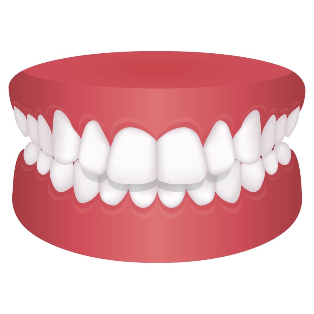 image of Protrusion